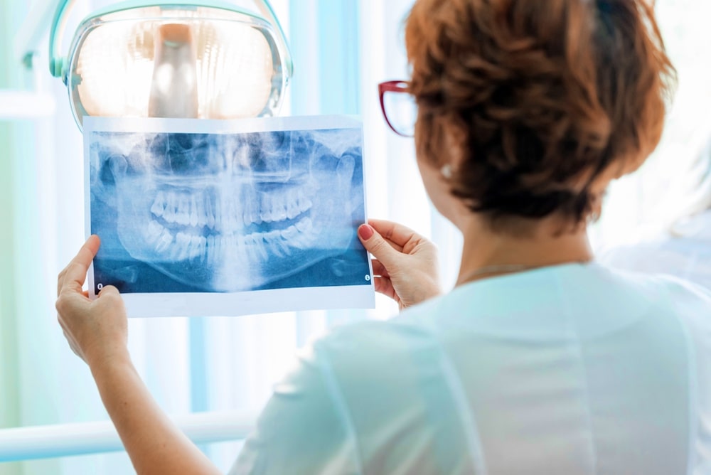 como funciona uma radiografia odontológica