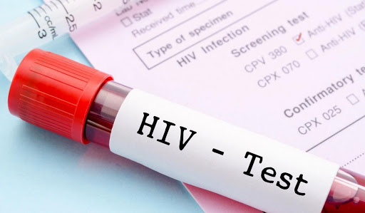 Testes de HIV em consultórios odontológicos
