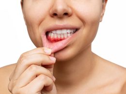 Pessoa mostrando gengivas e dentes saudáveis