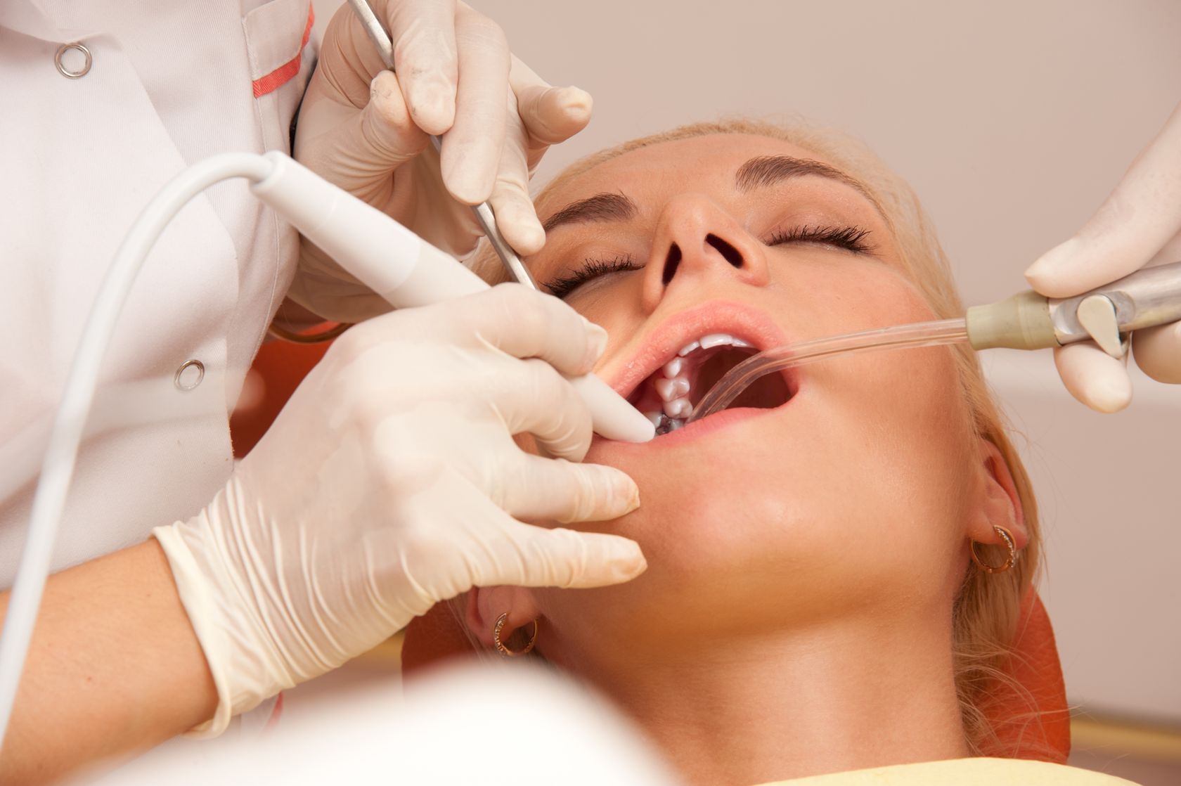 Entenda a importância da extração dos sisos para a saúde bucal