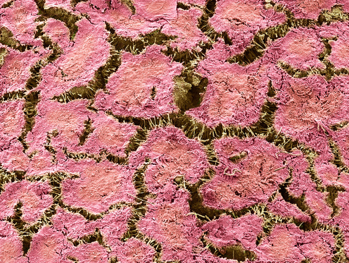 12 imagens de microscópio das bactérias encontradas na boca
