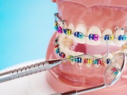 Modelo com cores das borrachinhas do aparelho diferentes.