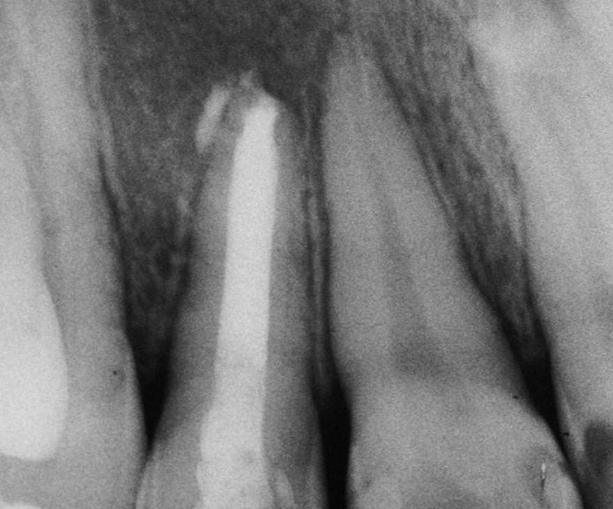 Proservação 5 meses Proservação 5 meses