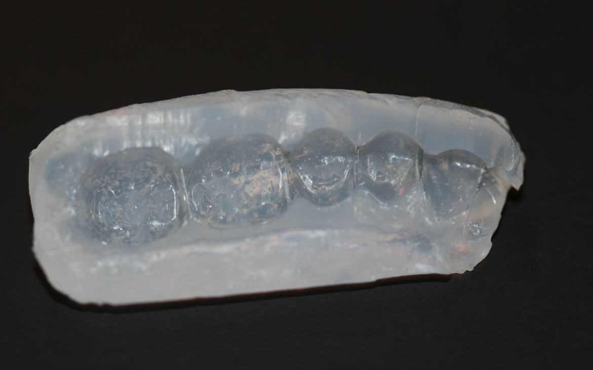 Vista interna da guia de silicone - espessura de 4mm nos bordos. Vista interna da guia de silicone - espessura de 4mm nos bordos.