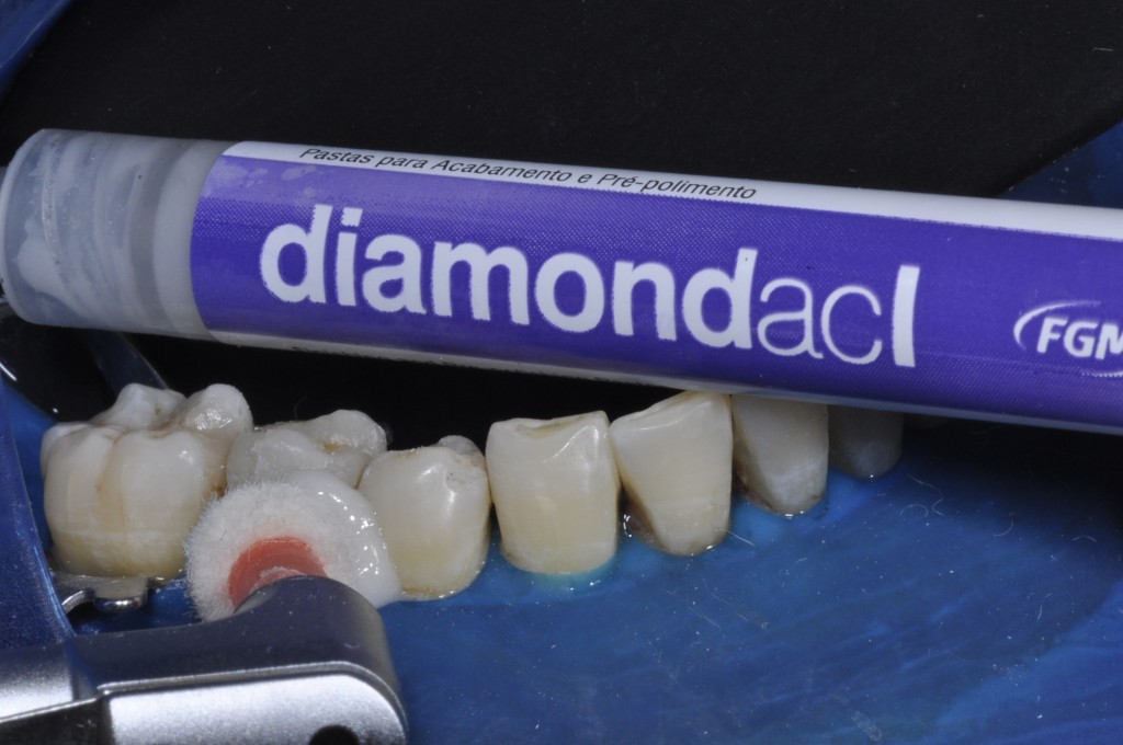Polimento com pastas diamantadas Diamond ACI (FGM) com Feltro Diamond (FGM) em baixa rotação