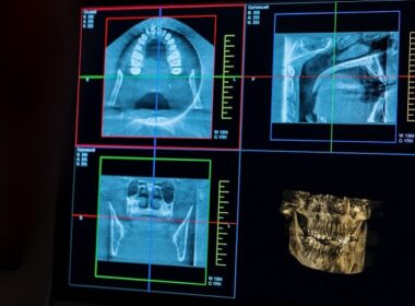 Imagens de radiografias sendo análisadas por dentista legal.