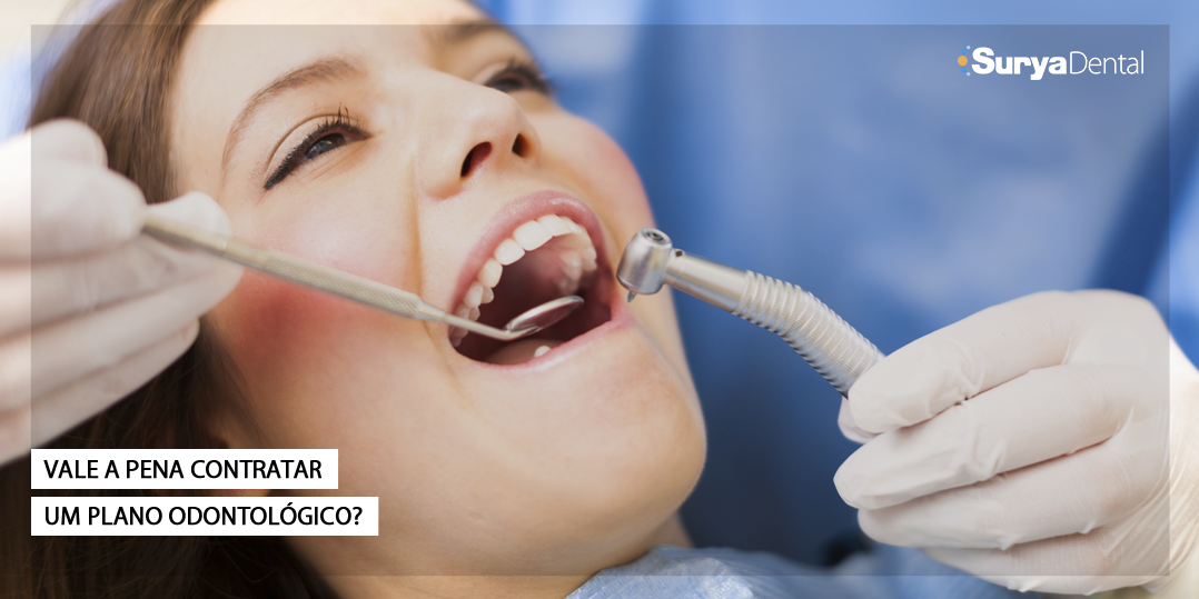 Vale a pena contratar plano odontológico? Respondemos a essa pergunta.