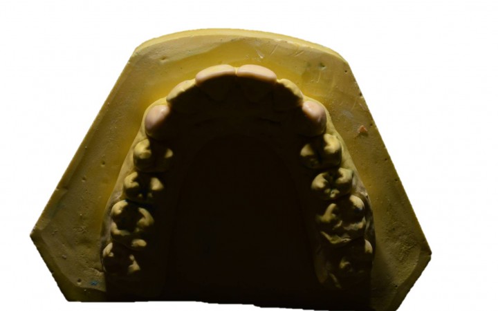 Molde Dental
