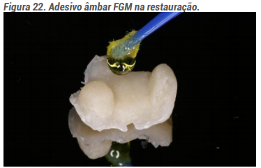 Adesivo âmbar FGM na restauração