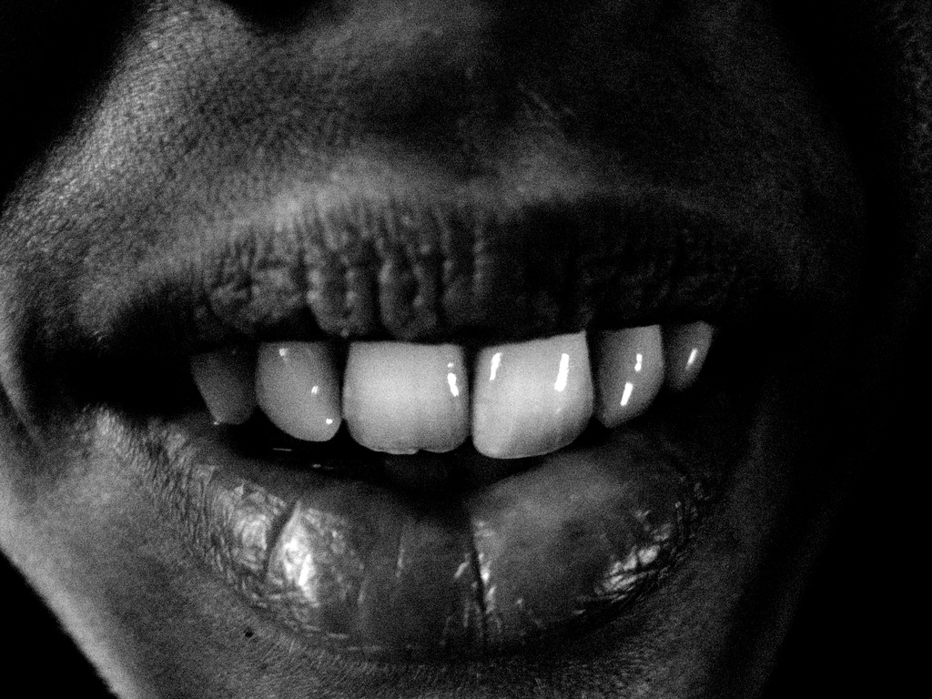 Erosão dental: saiba como identificar e por que tratar