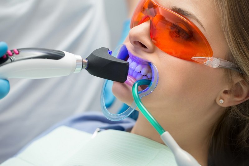 Clareamento dental com moldeira : 5 cuidados para seu paciente