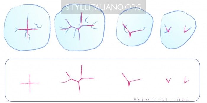 resina-bulk-fill-2 resina-bulk-fill-3m