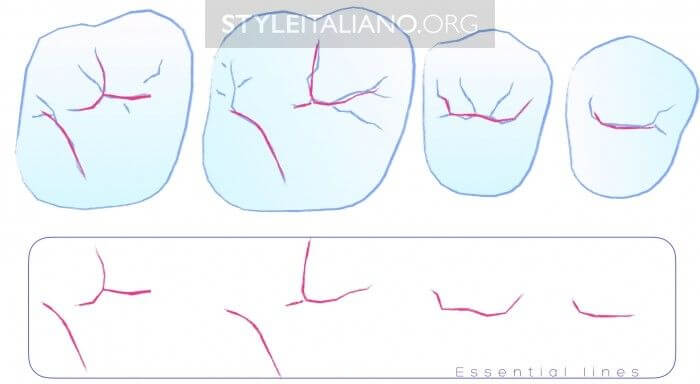 resina-bulk-fill-1 resina-bulk-fill-3m