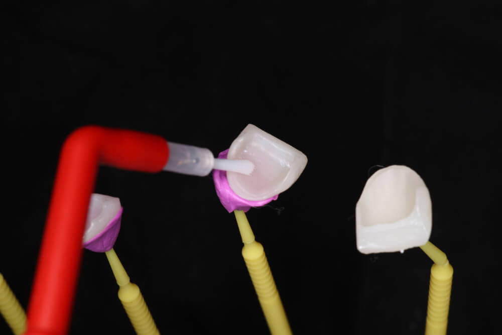 silano odontologia como usar silano na odontologia