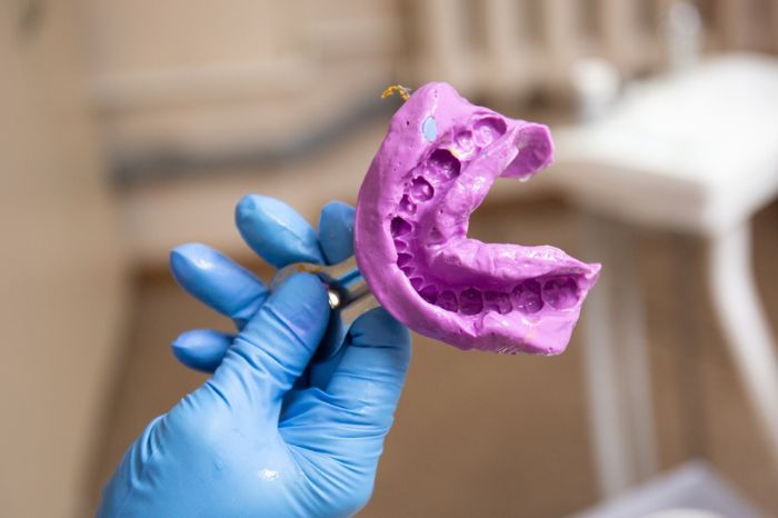 moldagem com silicone de adição