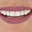 boca um pouco fechada mas mostrando os dentes durante sorriso