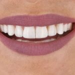 boca um pouco fechada mas mostrando os dentes durante sorriso