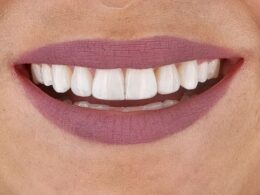 boca um pouco fechada mas mostrando os dentes durante sorriso