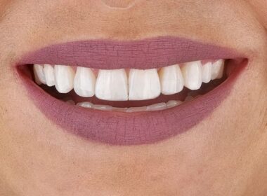 boca um pouco fechada mas mostrando os dentes durante sorriso