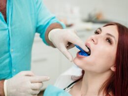 Pessoa com boca aberta enquanto dentista faz molde dos dentes