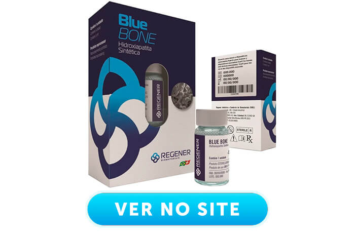 enxerto ósseo sintético Blue Bone