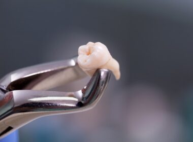 banco-de-dentes-humanos-dente-extraido