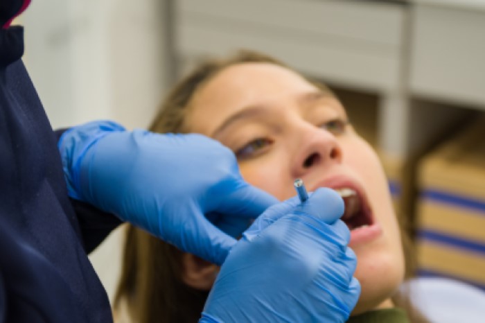 Dentista realiza avaliação da boca de paciente.