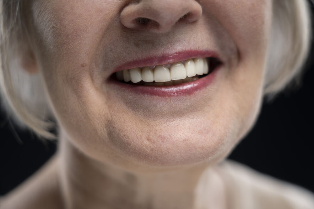 Sorriso de mulher idosa com dentes brancos e saudáveis.