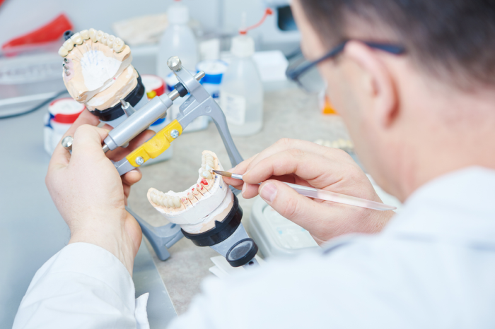 Dentista confeccionando prótese dentária com articulador odontológico.