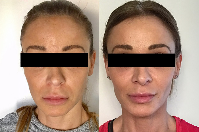 Imagem de uma mulher com uma imagem de antes e um depois