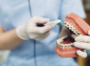 Profissional escovando aparelho ortodôntico