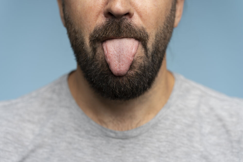 Homem mostrando a língua em close para avaliação de alterações ou inflamação das papilas linguais.